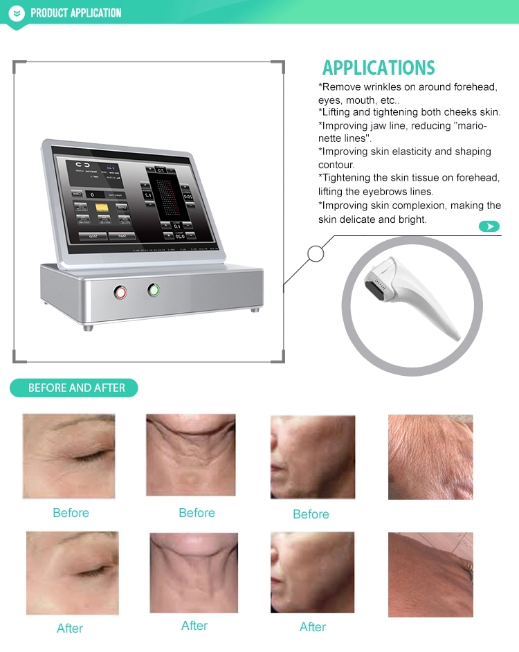 Professional 3d hifu face lifting machine/11 lines 3d hifu/ wrinkle removal hifu machine