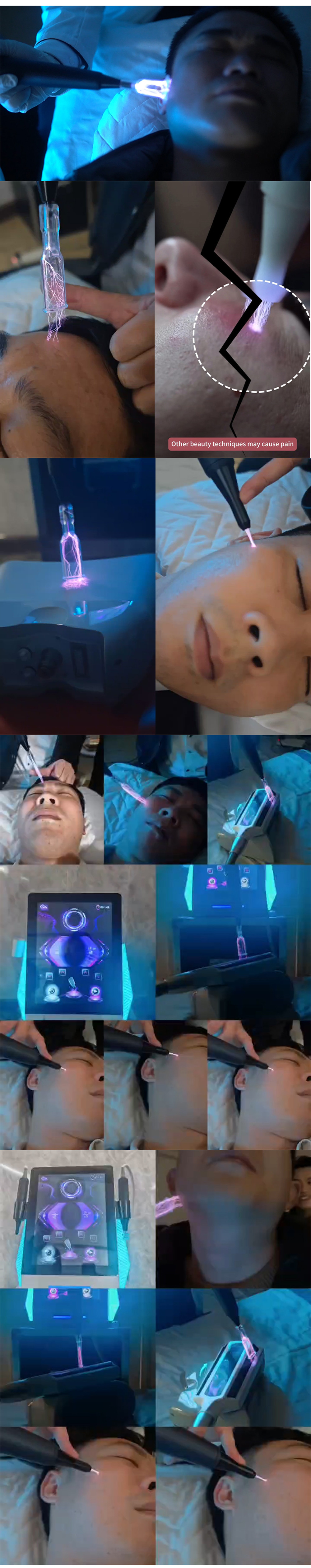 2025 Hot Sell Cold Plasma Skin Machine Cold plasma Pen German 8 In 1 Fractional Hot And Cold Plasma For Spots.