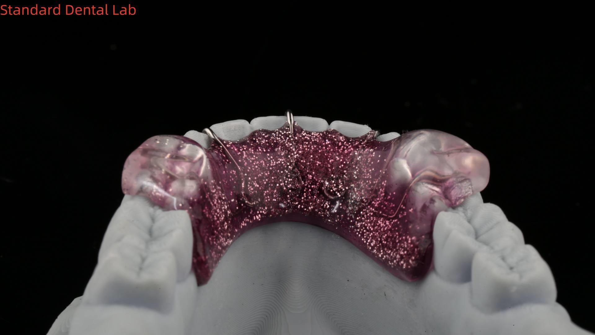 Teeth Expansion And Distalization Adjusting Expander In Mouth Orthodontist Palate Expander