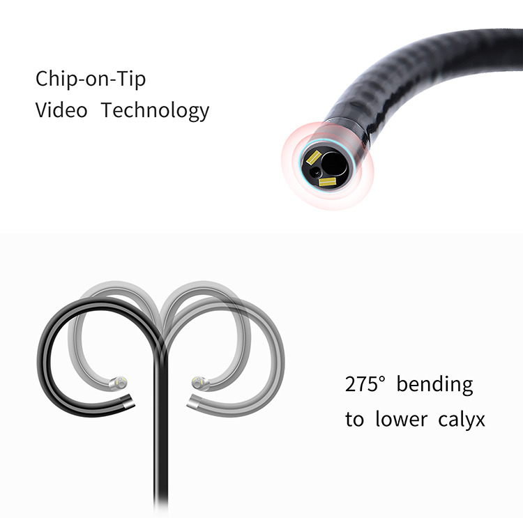 Flexible Video Ureteroscope Urological