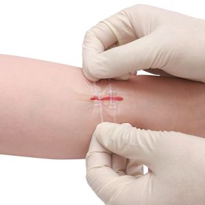 Flexible Fabric Bandages Wound Closure Device 2 / 4 / 6PCS