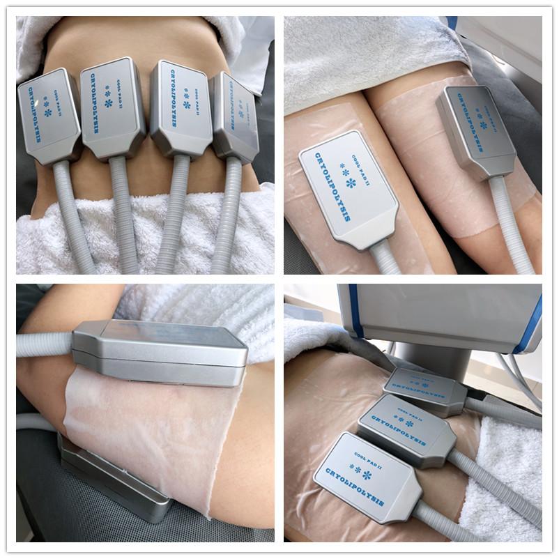 4 Handles 30Hz Cryolipolysis EMS Machine For Body Slimming