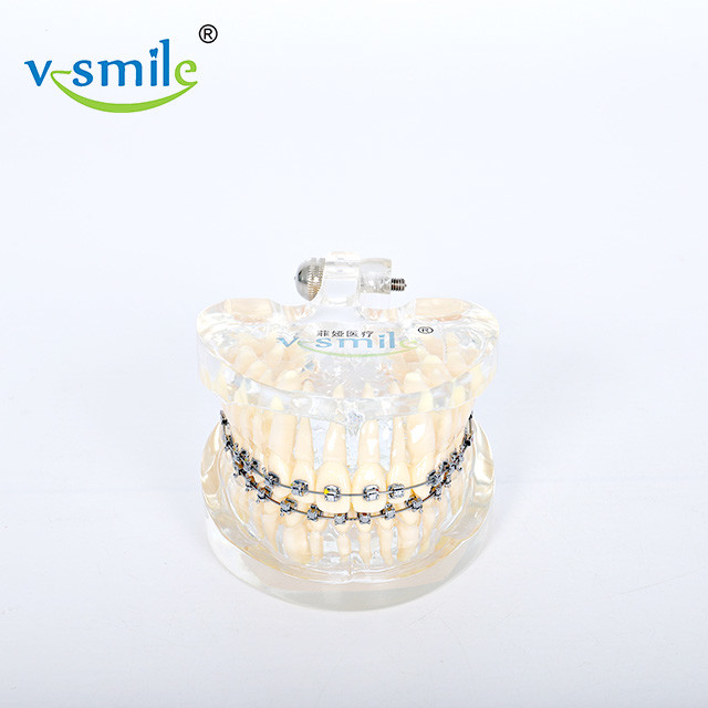022" Passive Self Ligating Orthodontic Brackets