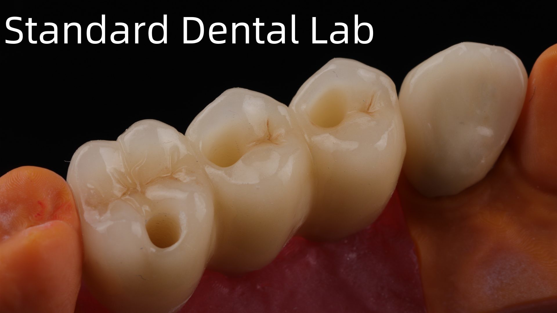 Professional Zirconia Dental Implant Crown Titanium CAD CAM Zirconia Crown China Dental Lab