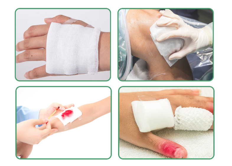 Accept OEM Absorbent Sterile Medical Wound Dressing Compress Gauze Swab Pad