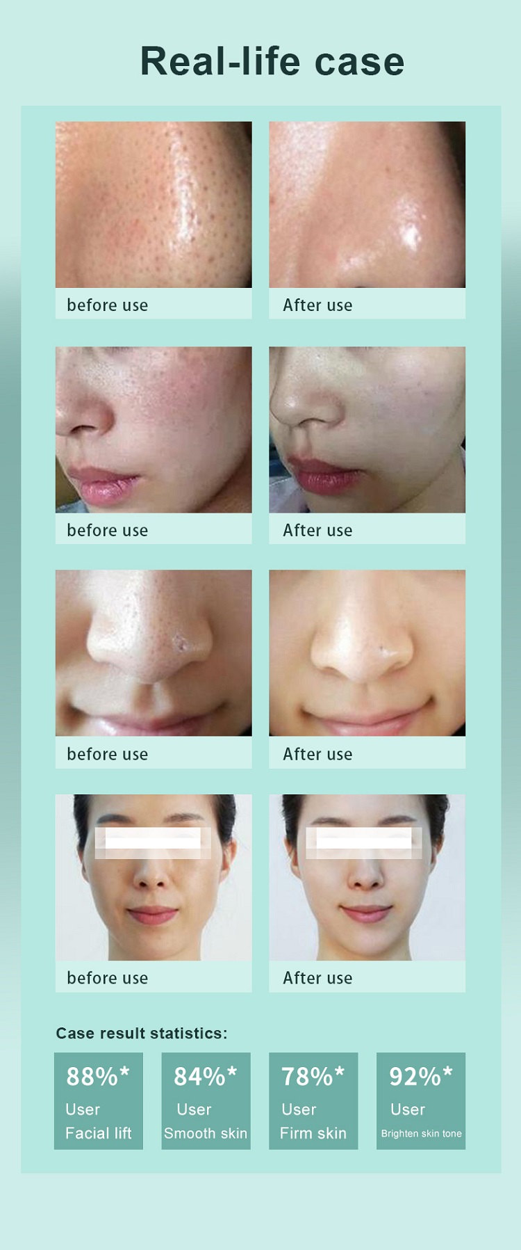 250W 8 In 1 Hydrafacial Machine 110V - 220V Hydradermabrasion Machine
