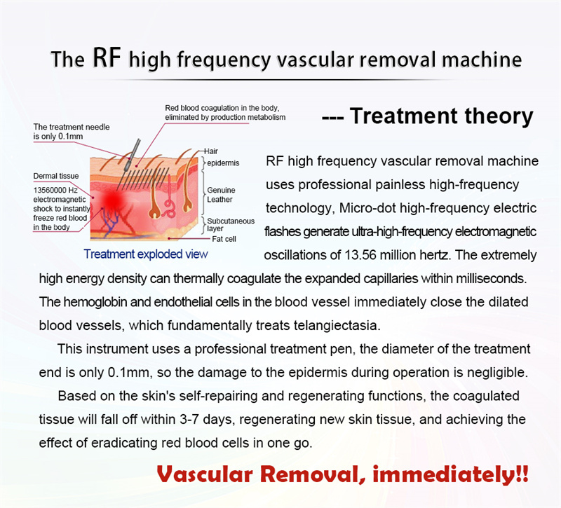 Vascular Spots Varicose Veins Removal Machine RF 980nm Diode Laser