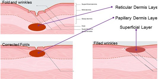 cpt skin rejuvenation machine fractional microneedle radiofrequency