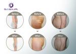 New Technology Cryotherapy Slimming Machine Effective In Body Slimming