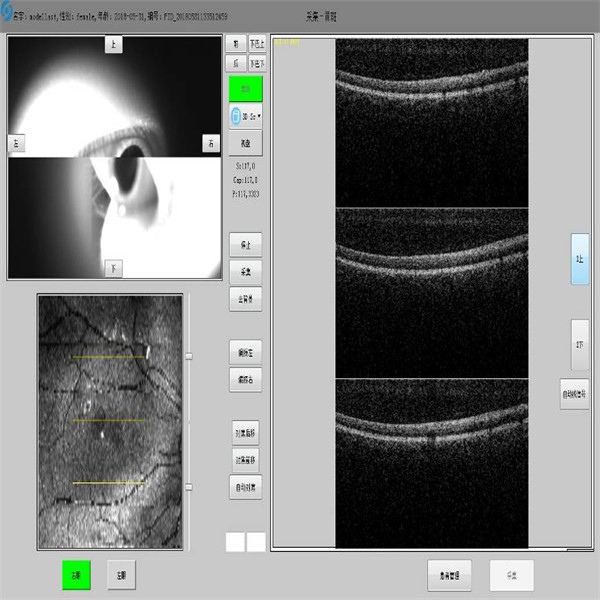 Class I Optical Coherence Tomography Device Continuous Operation Medical Electrical