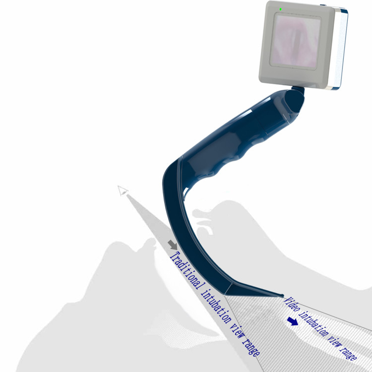 Conventional Camera Laryngoscope Microlaryngoscopy With Biopsy