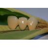 Buy cheap ISO13485 Good Biocompatibility PFM Non Precious Dental Crown from wholesalers