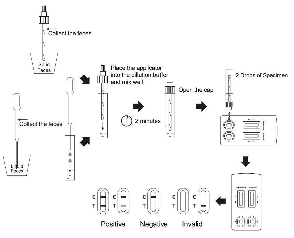 10T Calprotectin And Lactoferrin Test For Inflammatory Gastrointestinal Disorders