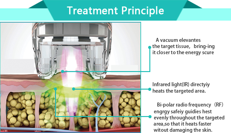 Treatment-principle
