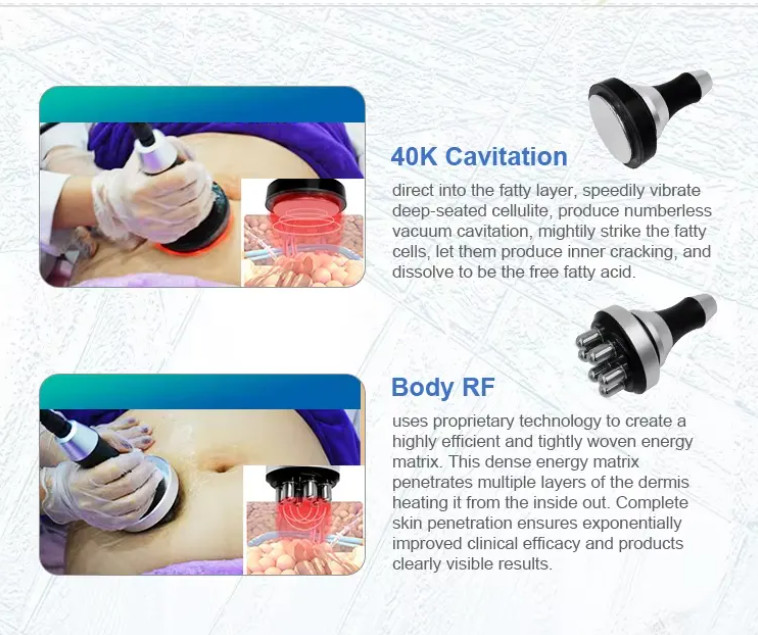 2 In 1 Cellulite Removal EMS Muscle Building Cryotherapy Body Slimming Machine