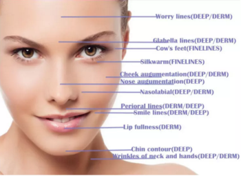 1ml Deep Wrinkles Hyaluronic Acid Injection Dermal Filler Cross Linked