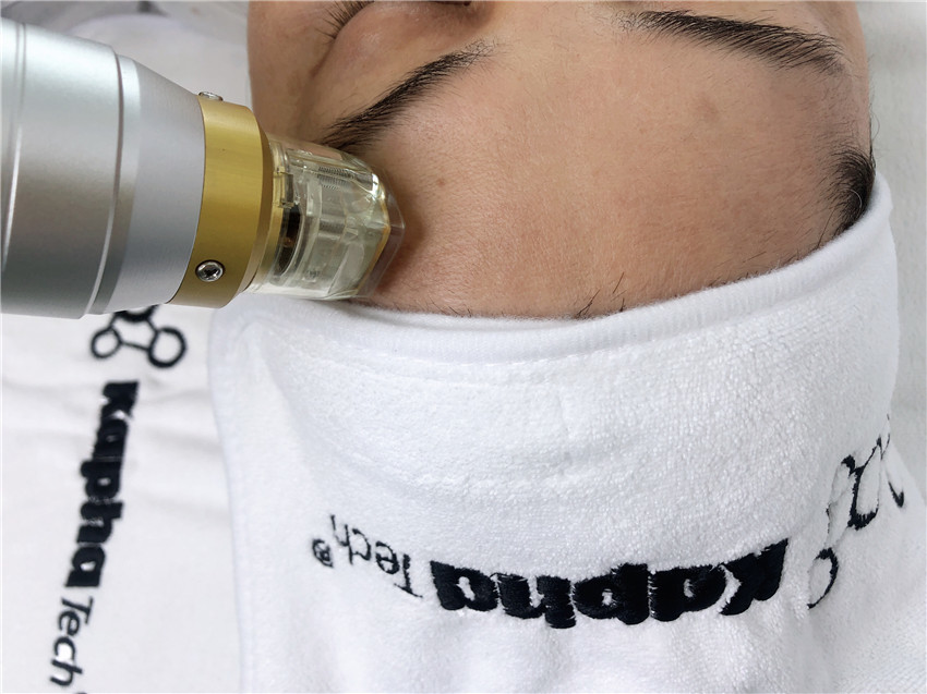 Thermal Cooling Microneedling Fractional RF Face Lifting