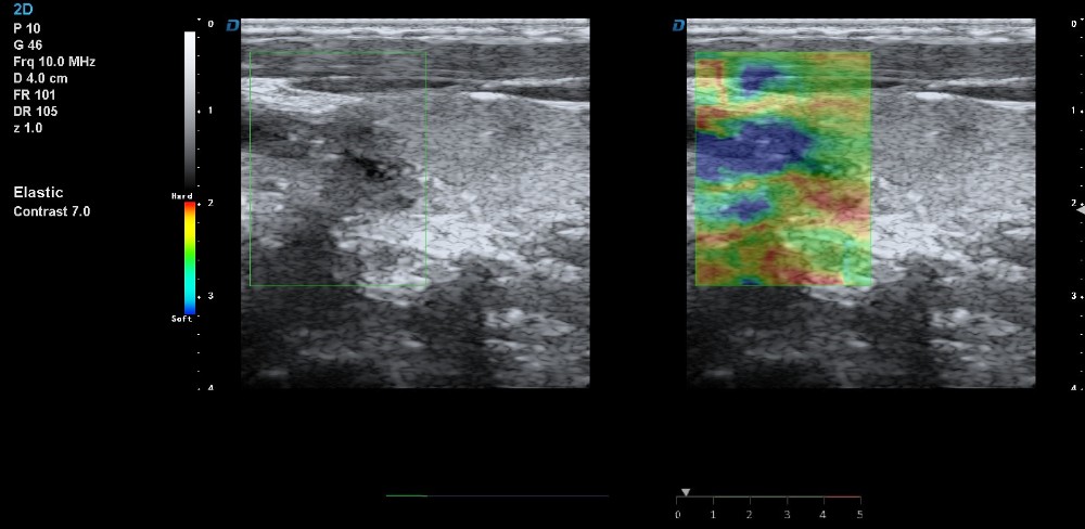 New arrival DW-T8 Elastography trolley ultrasonic scanner 4D cardiac color doppler ultrasound with TDI