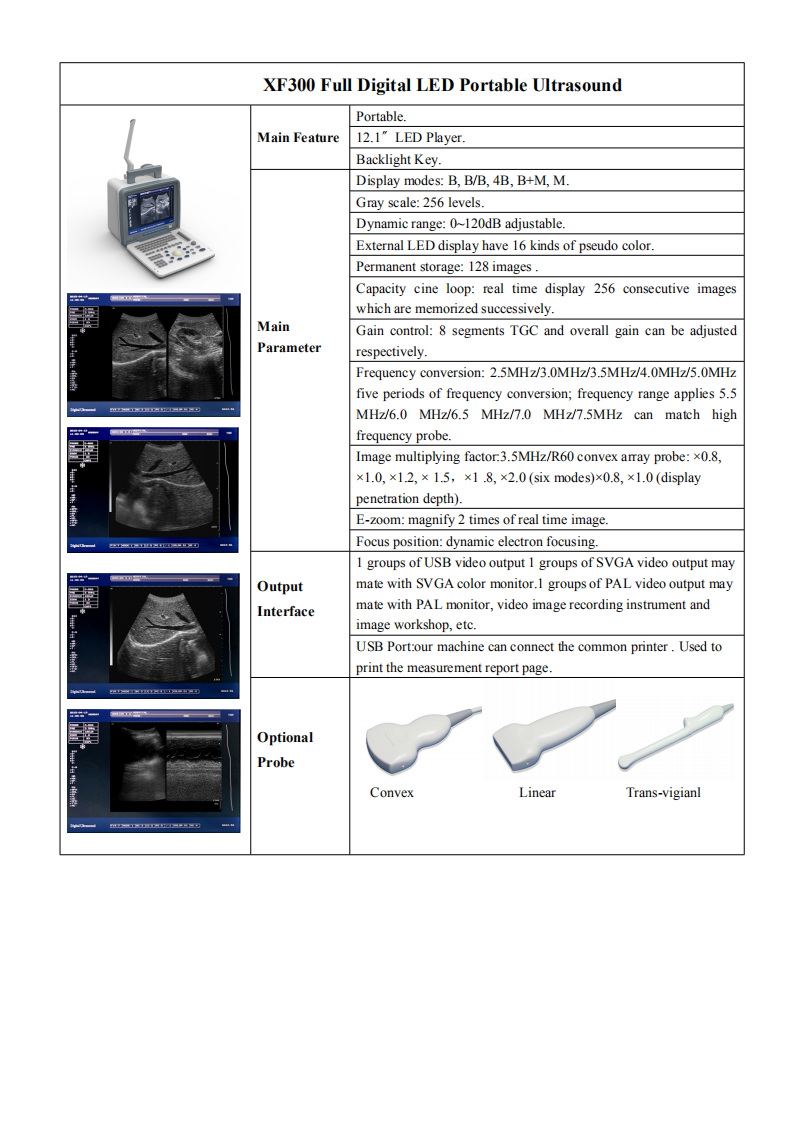 Full Digital OB GYN USG Scan Machine 0 To 120dB 12in Led Display