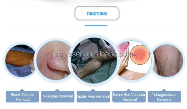 Portable 30mhz Laser Spider Vein Removal Machine , 110v 980nm Diode Laser Vascular Removal Machine
