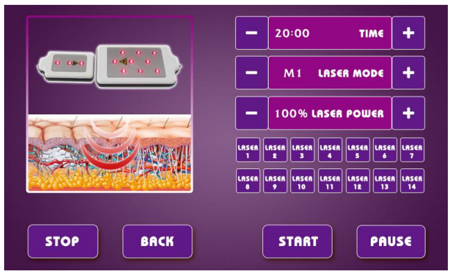 Ultrasonic Lipo Laser Face Rf Beauty 40k Cavitation Machine