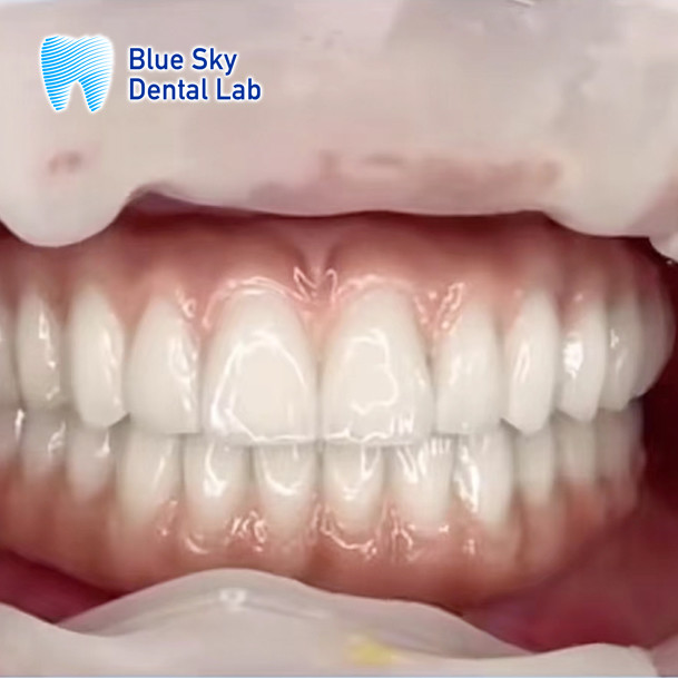 Customized Surgical Smooth Steam Sterilization Universal Compatibility Implant procedure cases