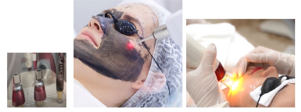 Q Switched ND Yag Laser Hair And Tattoo Removal Machine Portable 2000w 10.4 Inch Screen