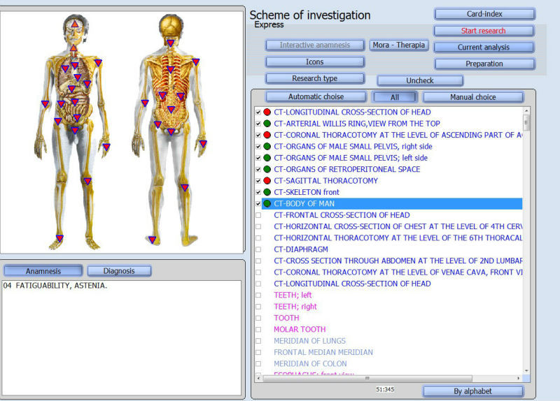 8D Lris NLS Stable and Faster Health Diagnosis Disease Detecting at Home Physiotherapy