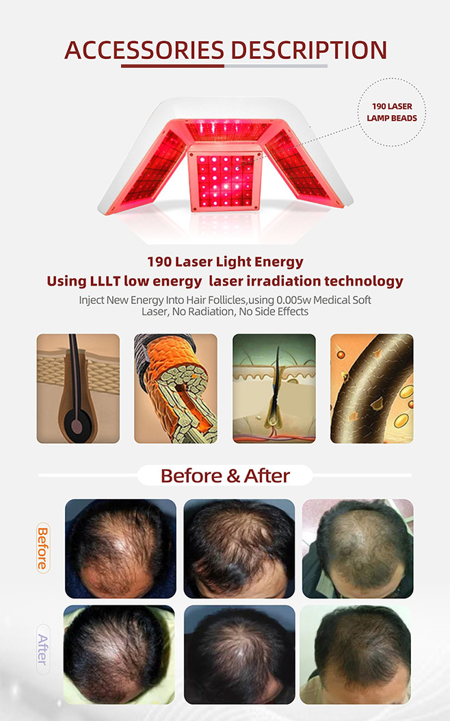 Red Light Laser Hair Regrowth Machine , Follicles Treatment Hair Growth Device