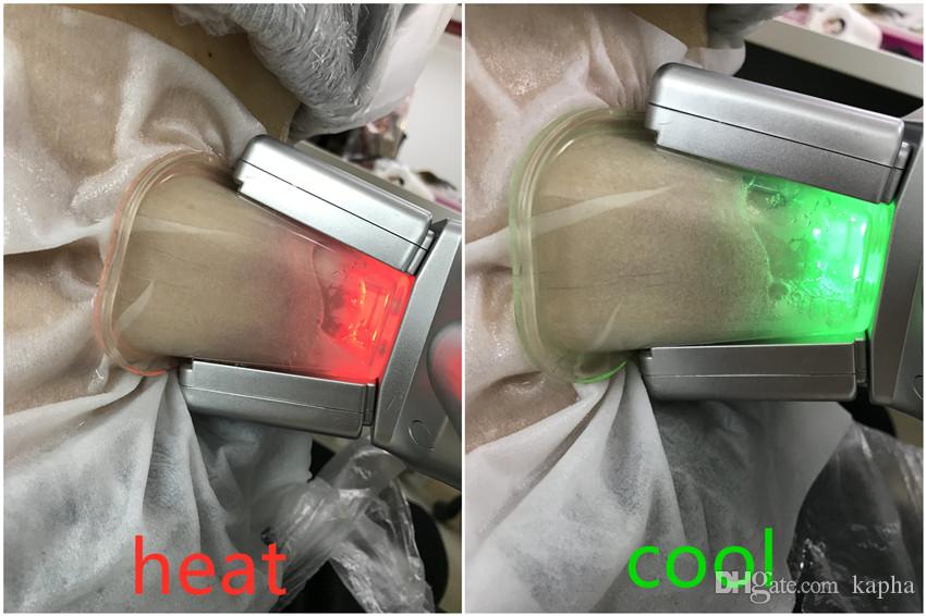 RHOSE Mini 10 Kpa Cryolipolysis Fat Freezing Machine