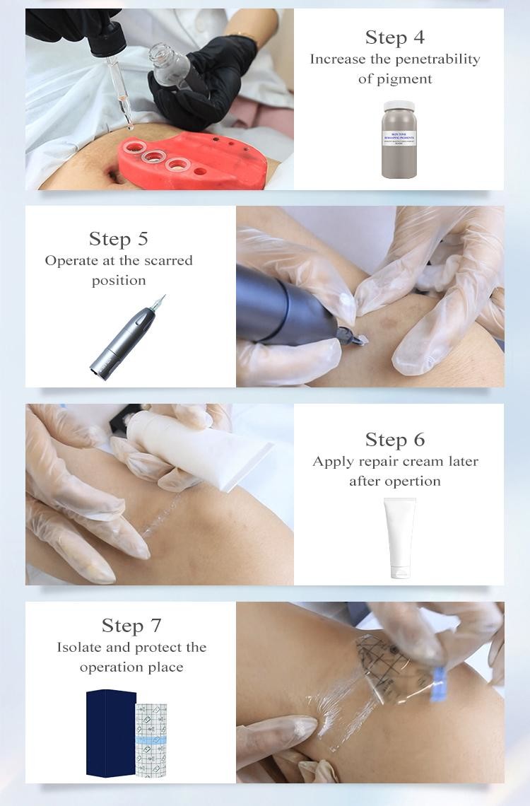 ODM 15ml Permanent Makeup Pigments Remove Skin Care Products