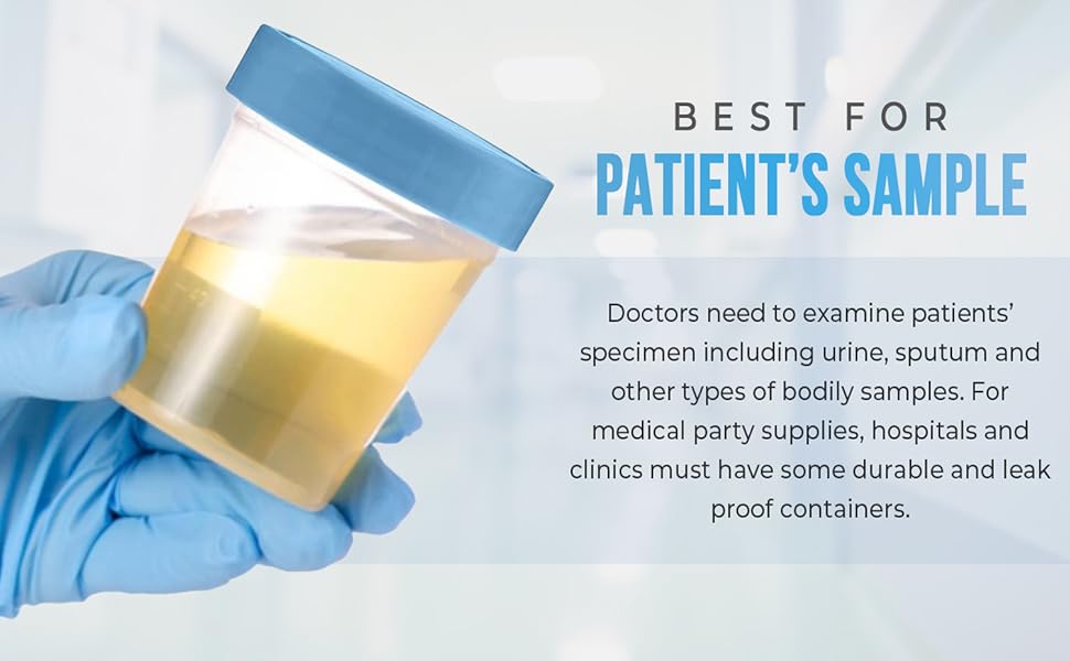 patient's sample urine container