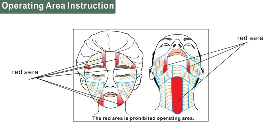 vertical hifu for skin tighting