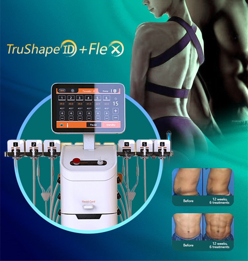 Trusculpt Body Slimming Monopolar Rf Machine 2 In 1 Trushape Id Flex
