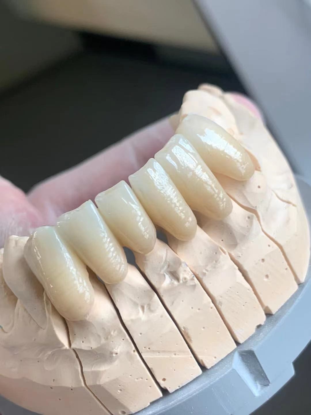 ST Color Pre Shaded Zirconia Blocks Dental CAD CAM System Dental Zirconia Ceramic Blocks