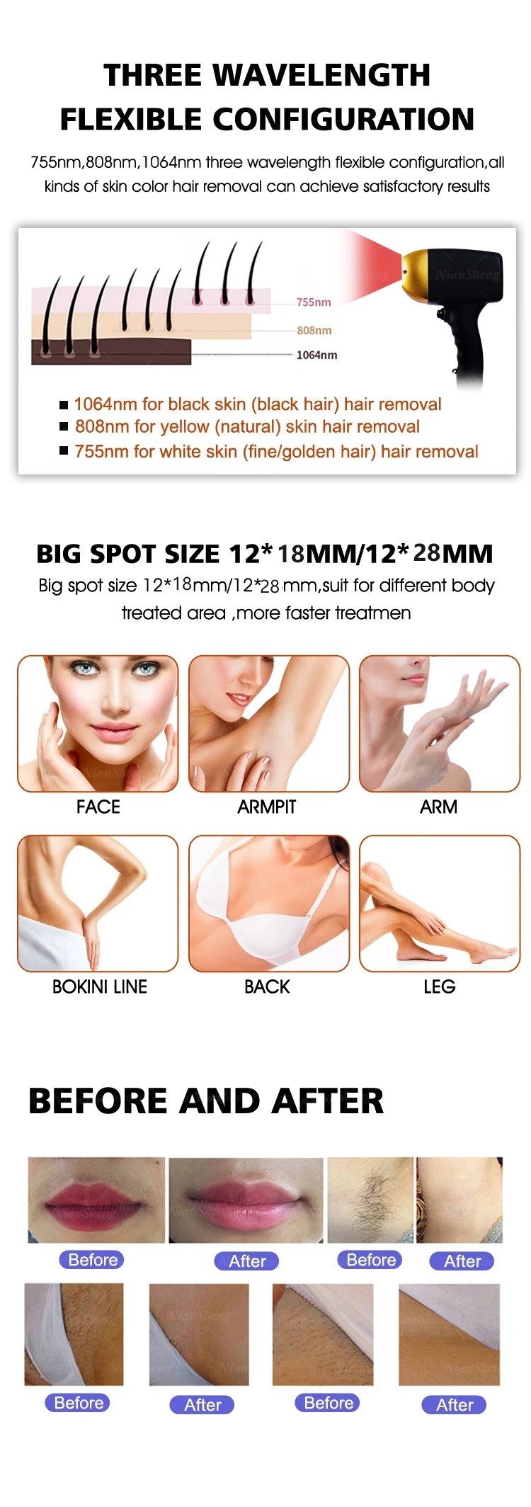 12x18mm2/12*28mm Spot Size 808nm Diode Laser Hair Removal Machine Painless