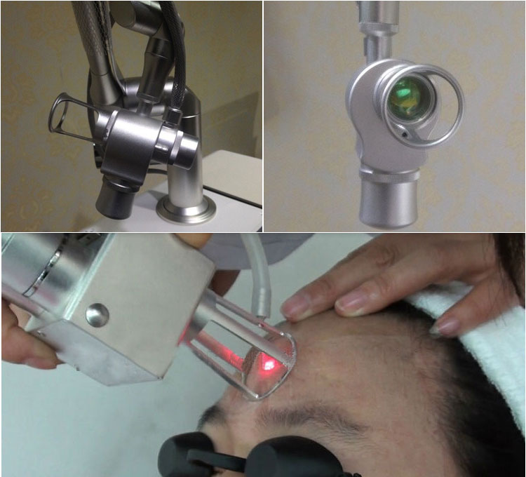 best stretch mark removal after brith recover verginal tightenig fractional C02 laser machine