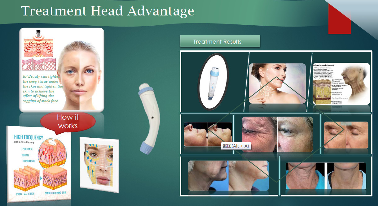 4 In 1 Ipl Yag Rf Diode Laser Machine Lasertell Hair Tattoo Removal