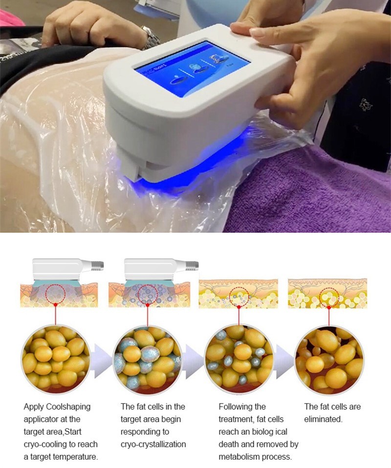 360 Degree Working Cryo Weight Loss Machine Body Sculpting And Reduce Fat