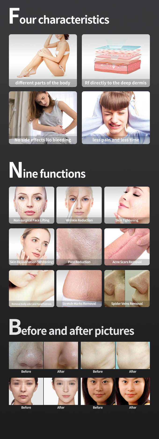 Thermolift Fractional RF Microneedling Machine 60Hz non surgical facelift machine