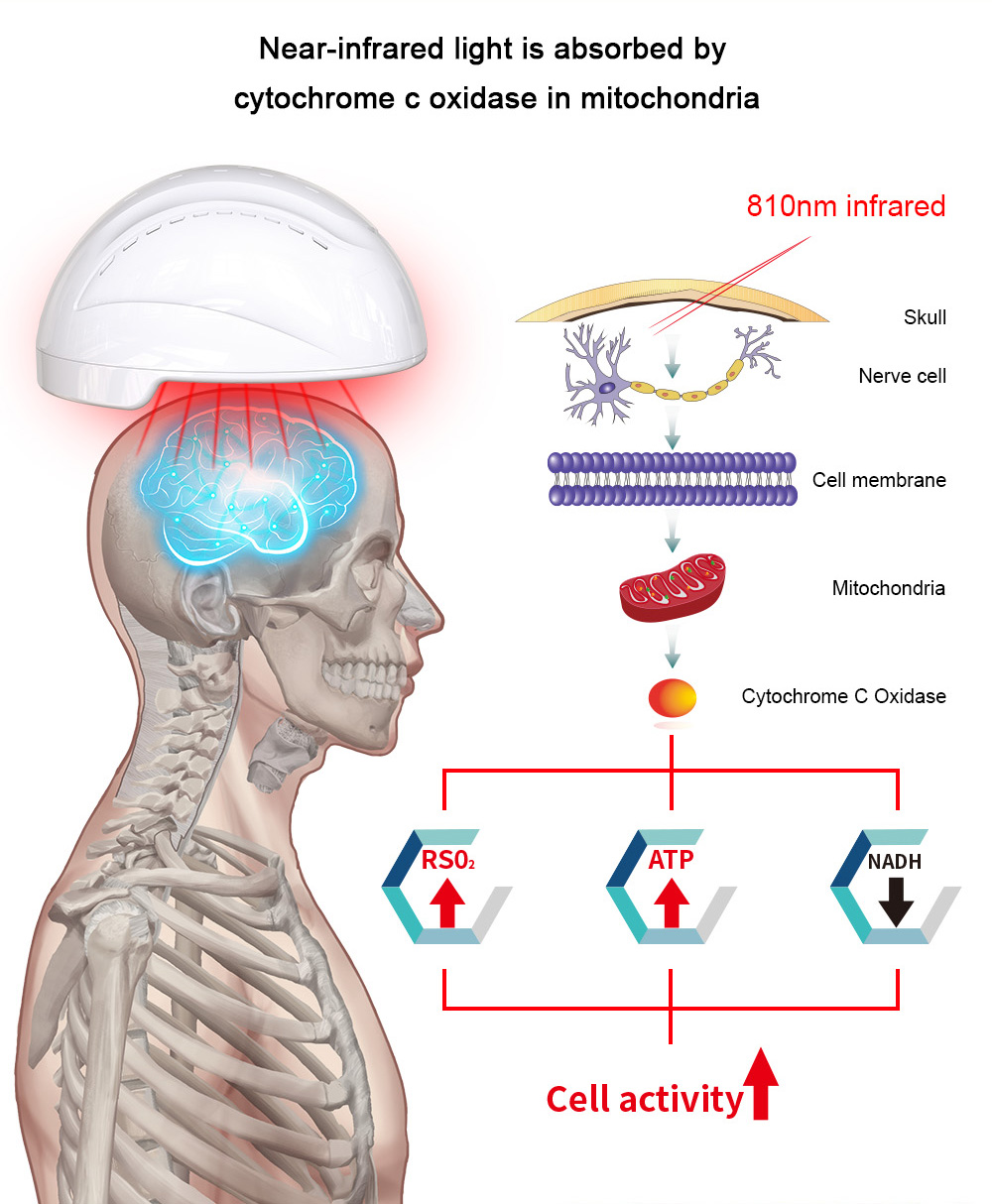810nm Transcranial Magnetic Stimulation Neurofeedback Devices Physiotherapy