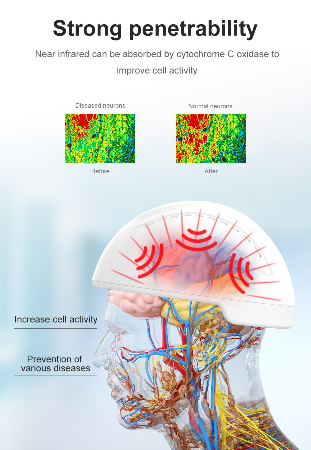 810nm Transcranial Magnetic Stimulation Neurofeedback Devices Physiotherapy