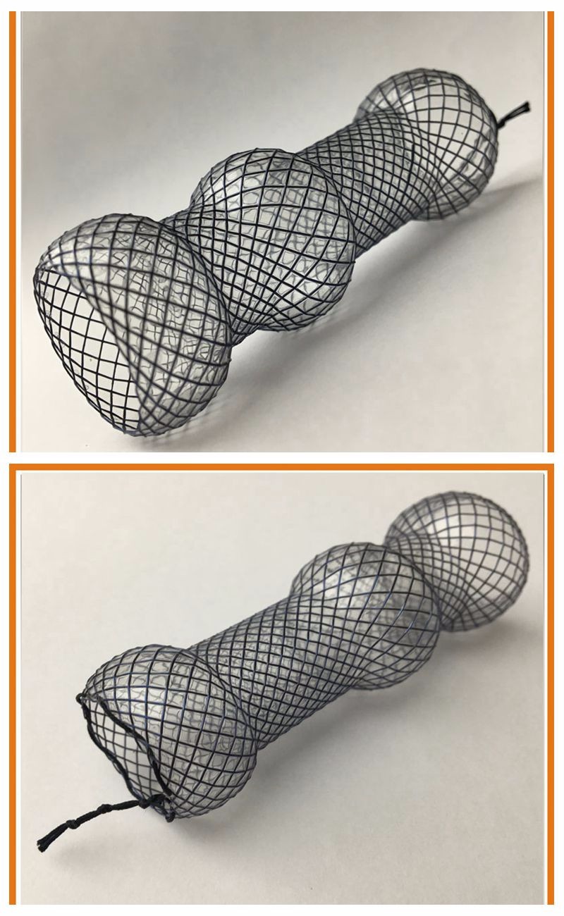 Surgical Ni-Ti Alloy Self-Expandable Oesophageal stent of Medical stent with Nitinol wire