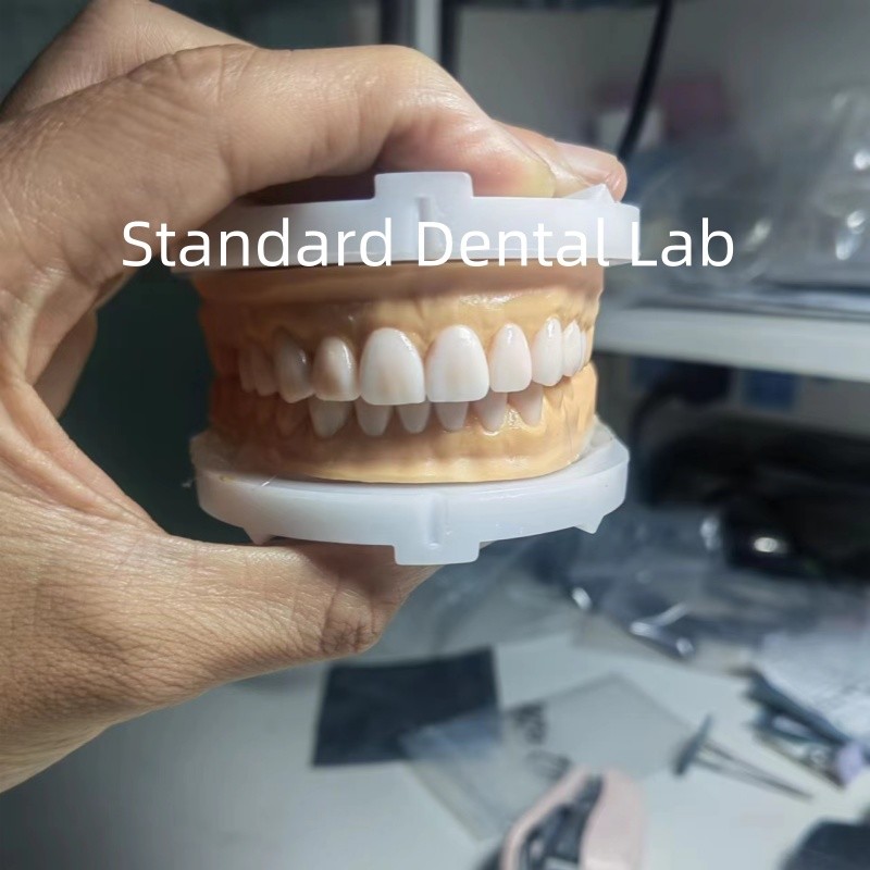 Perfect Esthetics Provisional Wax Up for Dental Professionals using dental wax from China Dental Lab