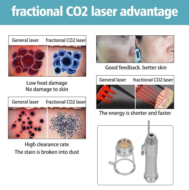 Portable 10600nm Co2 Fractional Laser Machine Pigment Removal Vaginal Tightening