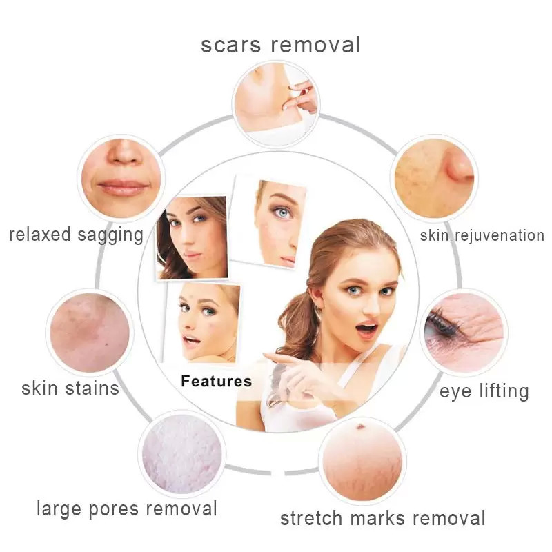 Face Lift RF Microneedling Machine Fractional Radio Frequency Skin Tightening