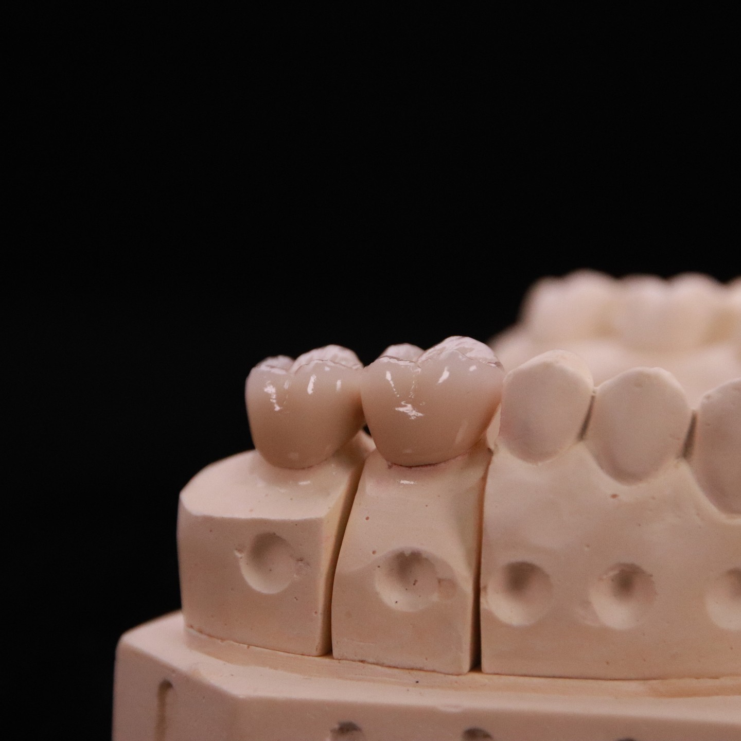 Comfortable Zirconia Crown with Precise Esthetic Finish Express 3-4 Day Turnaround Time