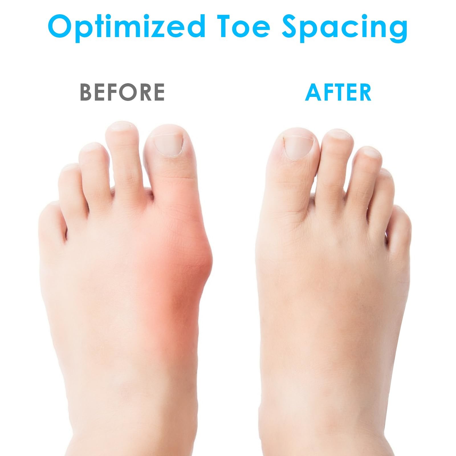 Silicone Toe Spacers For Correct Toe , Silicone Toe Separators For Bunions