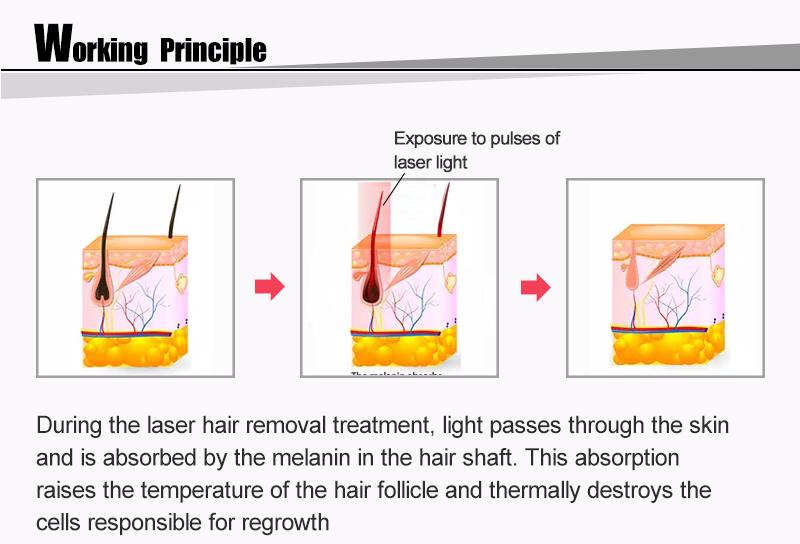 Skin Rejuvenation Laser Beauty Equipment Diode Depilation 808nm Hair Removal Machine