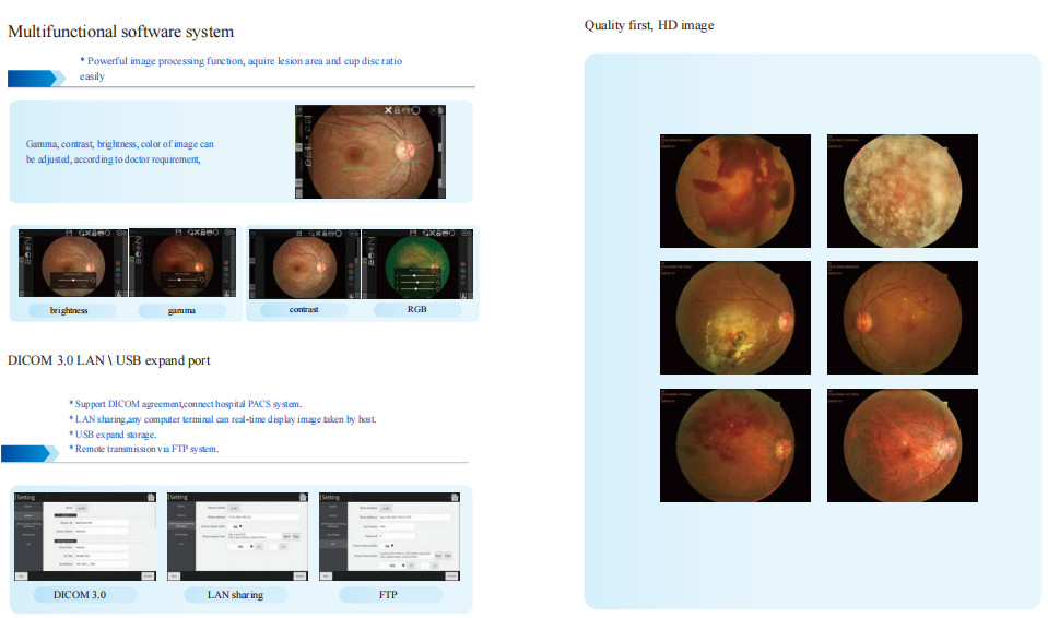 Automatic Non Mydriatic Fundus Camera 60mm Smaller Size Auto Pupil Searching